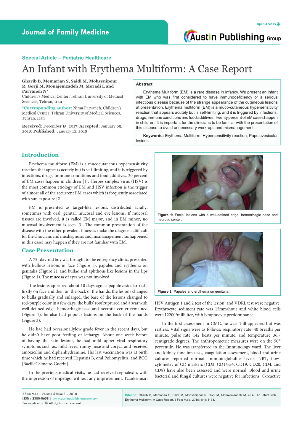 An Infant with Erythema Multiform: a Case Report