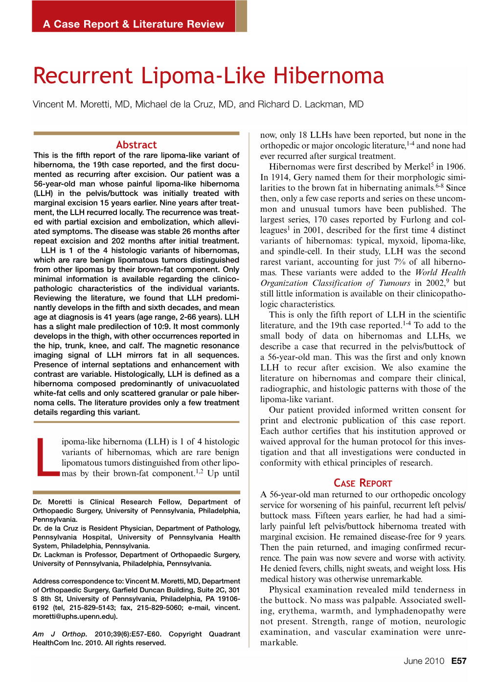 Recurrent Lipoma-Like Hibernoma