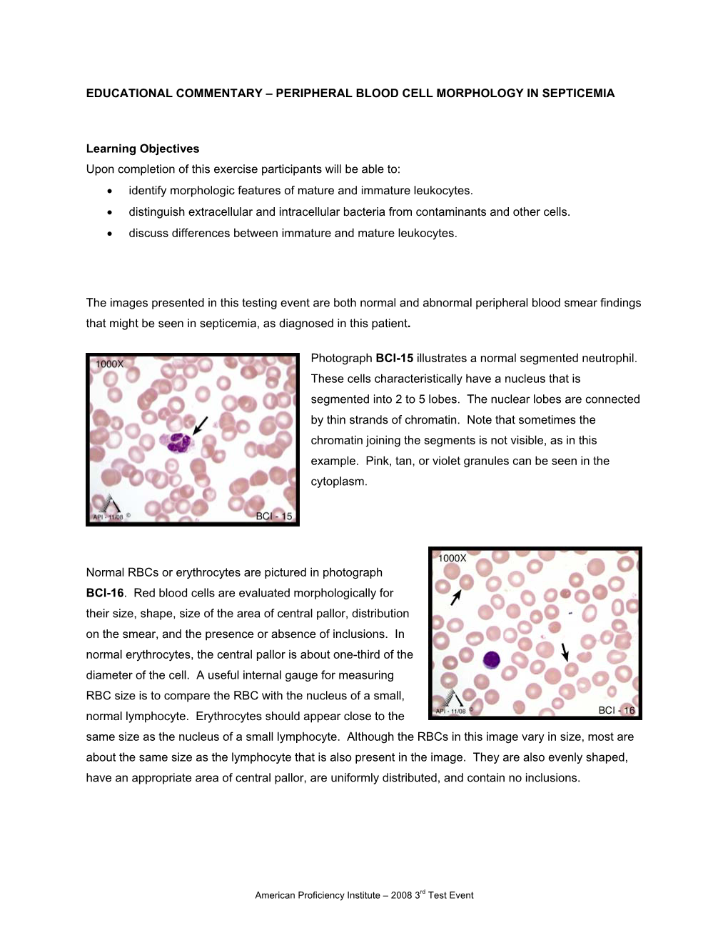 Peripheral Blood Cell Morphology in Septicemia