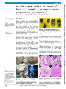 Complete Urorectal Septal Malformation with Left Hemimelia in a Neonate