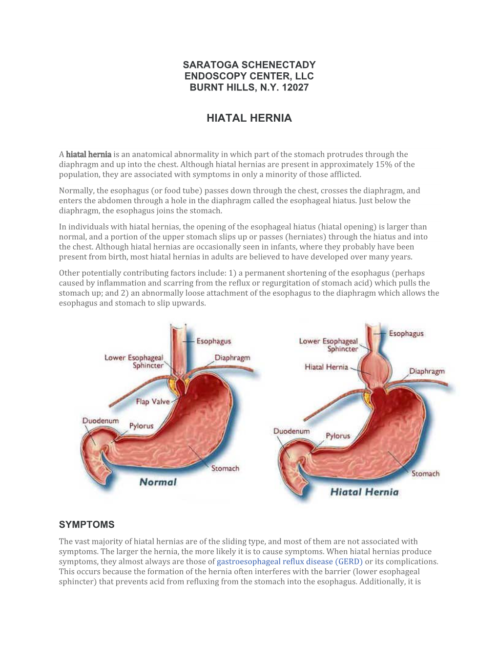 Hiatal Hernia