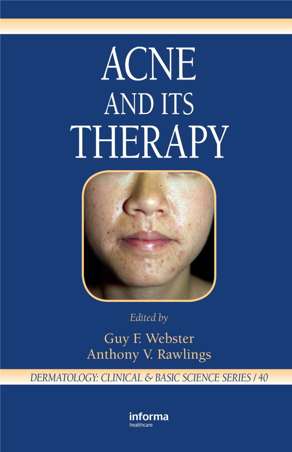 Acne and Its Therapy Basic and Clinical Dermatology