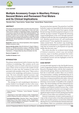 Multiple Accessory Cusps in Maxillary Primary Second Molars And