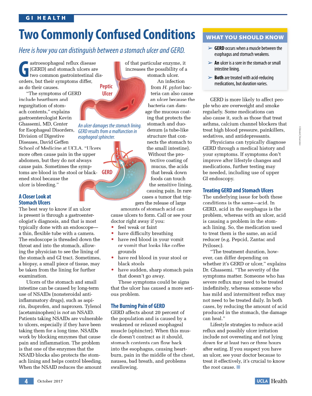 Two Commonly Confused Conditions WHAT YOU SHOULD KNOW ➢ GERD Occurs When a Muscle Between the Here Is How You Can Distinguish Between a Stomach Ulcer and GERD