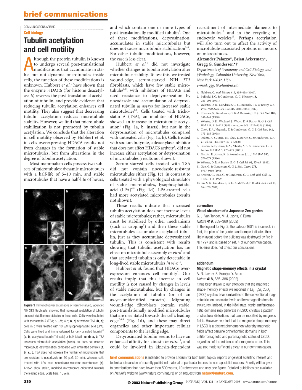 Tubulin Acetylation and Cell Motility