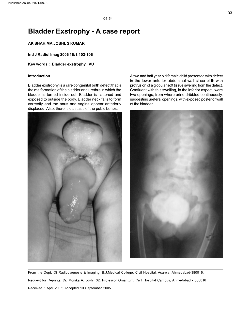 Bladder Exstrophy - a Case Report