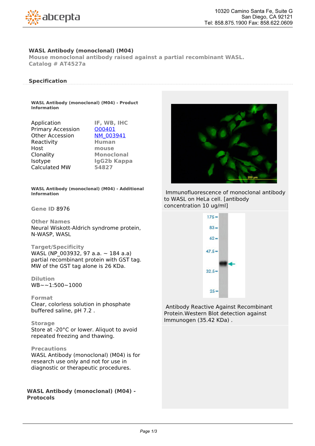 WASL Antibody (Monoclonal) (M04) Mouse Monoclonal Antibody Raised Against a Partial Recombinant WASL