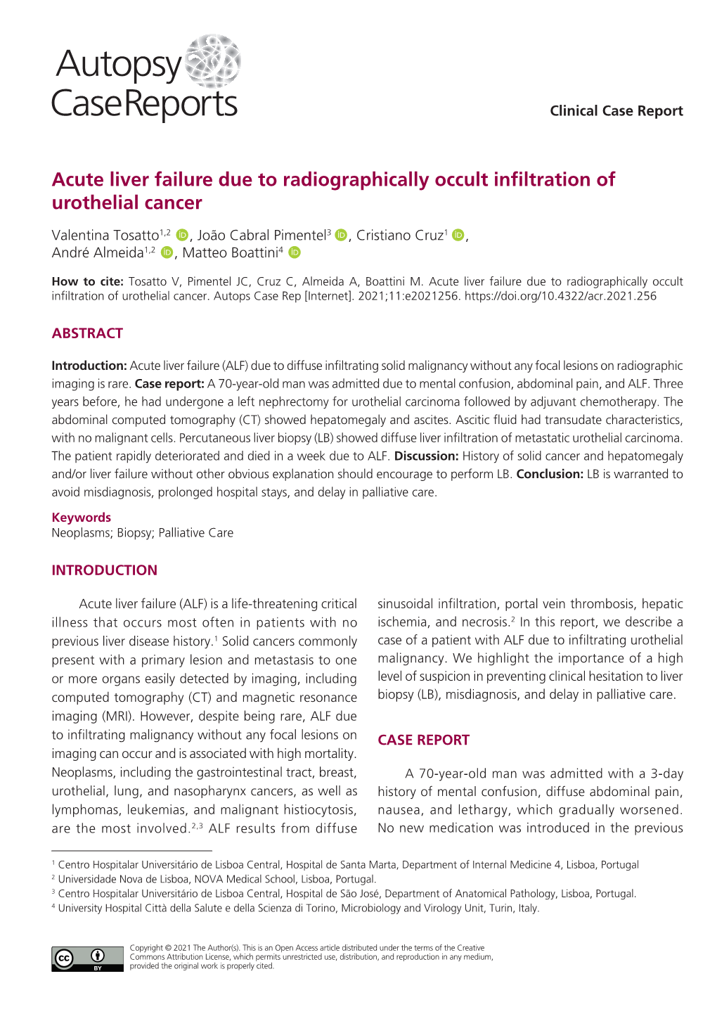 Acute Liver Failure Due to Radiographically Occult Infiltration of Urothelial Cancer