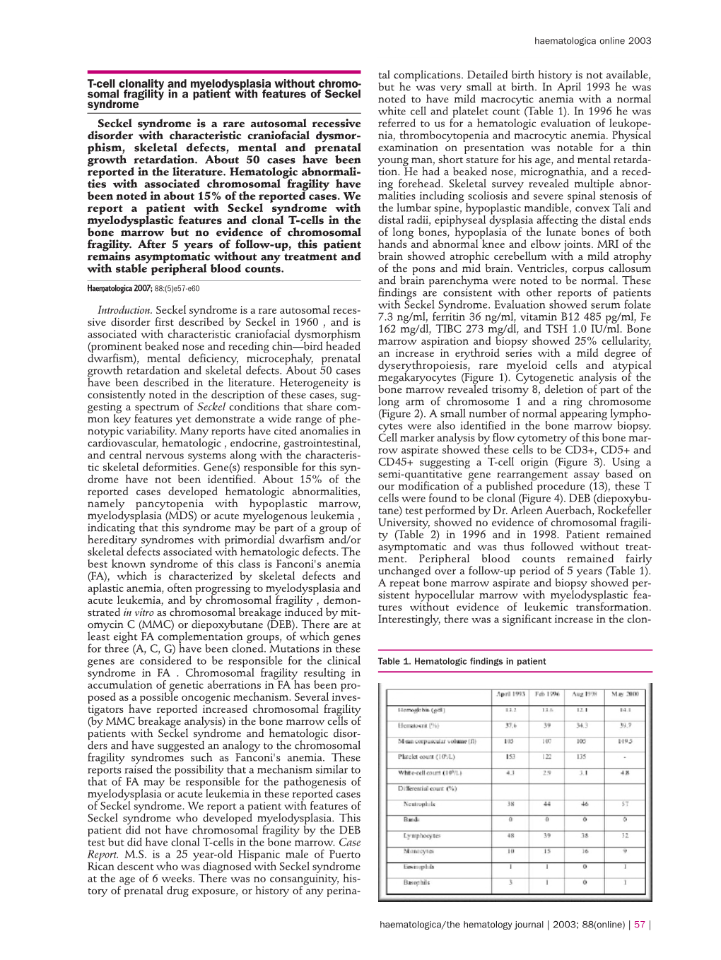 T-Cell Clonality and Myelodysplasia Without Chromo- Somal Fragility in a Patient with Features of Seckel Syndrome