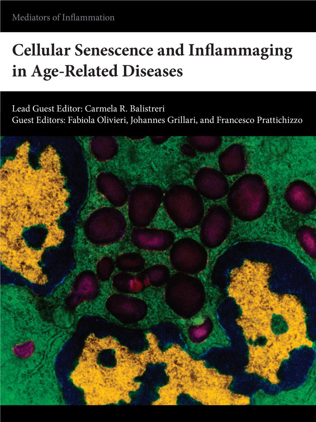 Cellular Senescence and Inflammaging in Age-Related Diseases