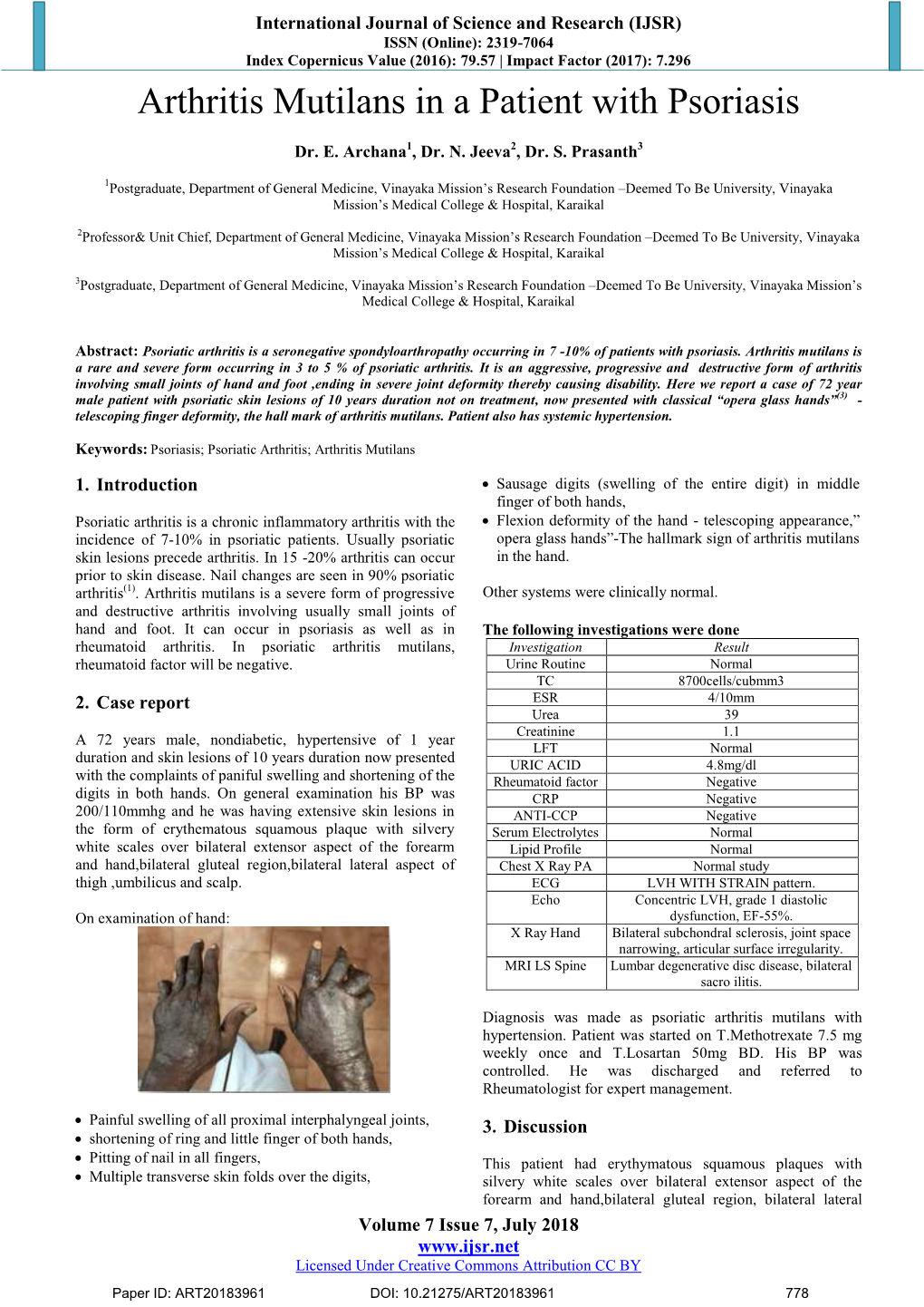 Arthritis Mutilans in a Patient with Psoriasis