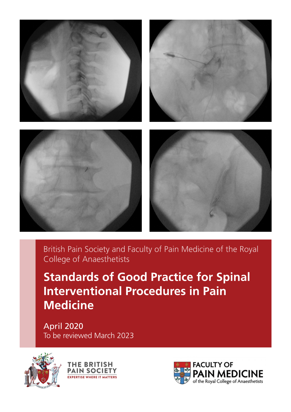 Standards of Good Practice for Spinal Interventional Procedures in Pain Medicine