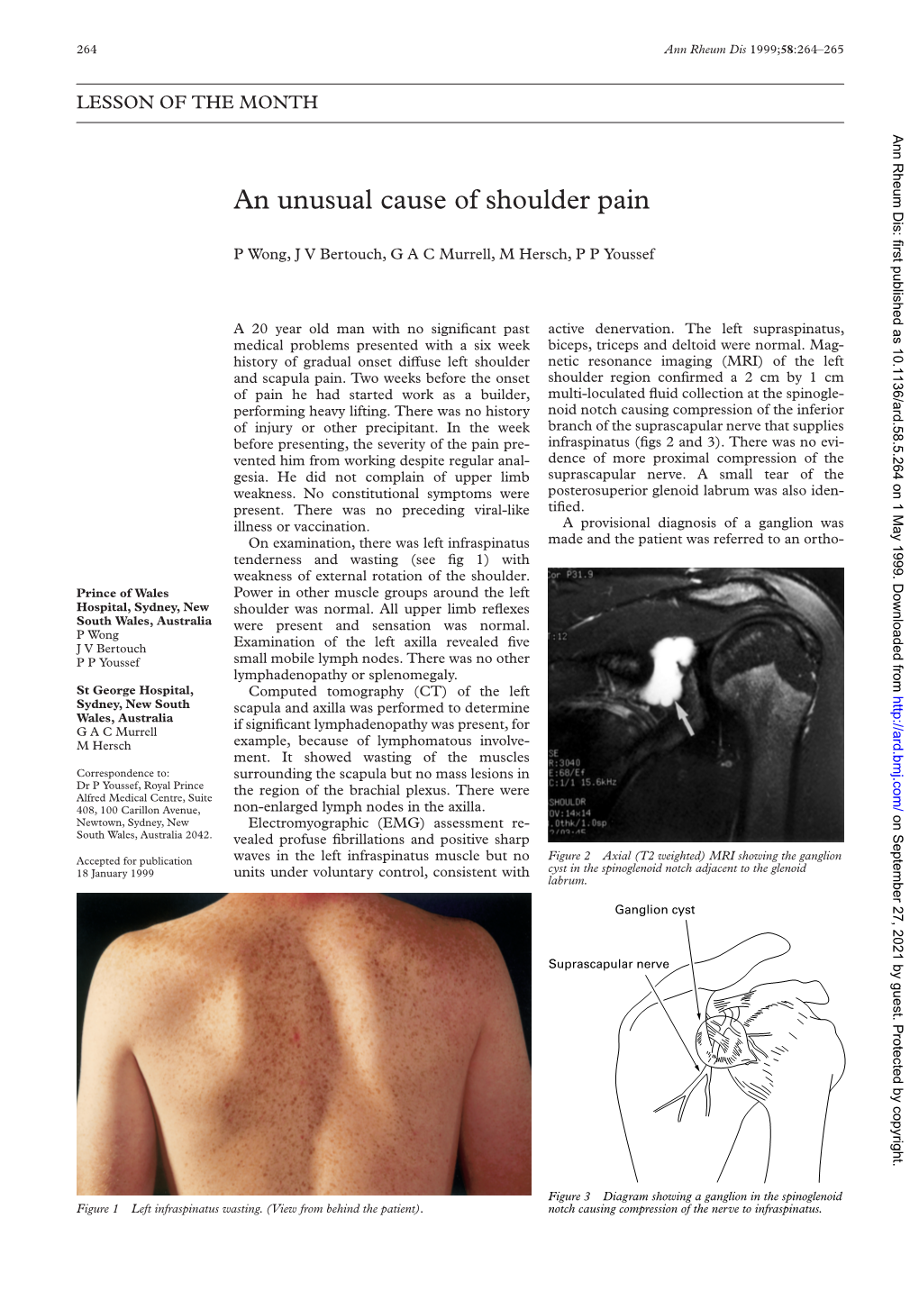 An Unusual Cause of Shoulder Pain