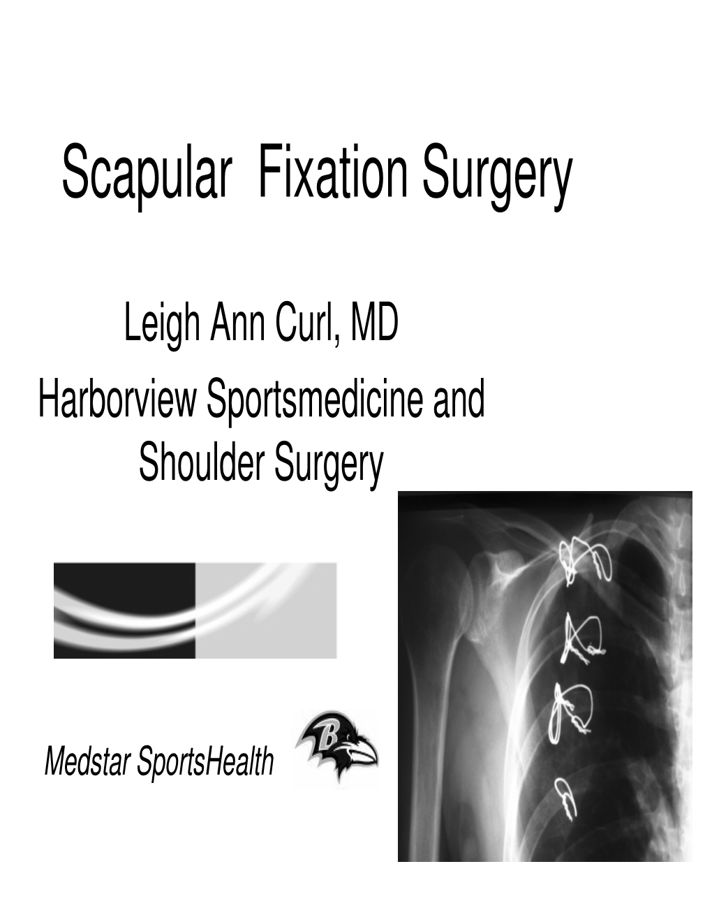 scapular-fixation-surgery-docslib