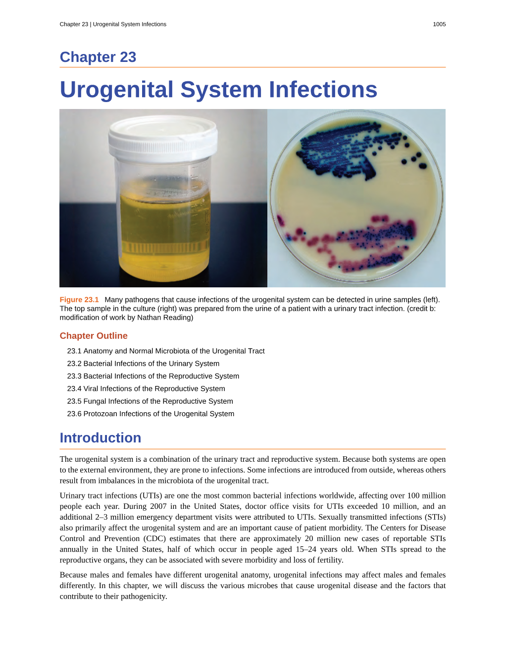 Urogenital System Infections 1005