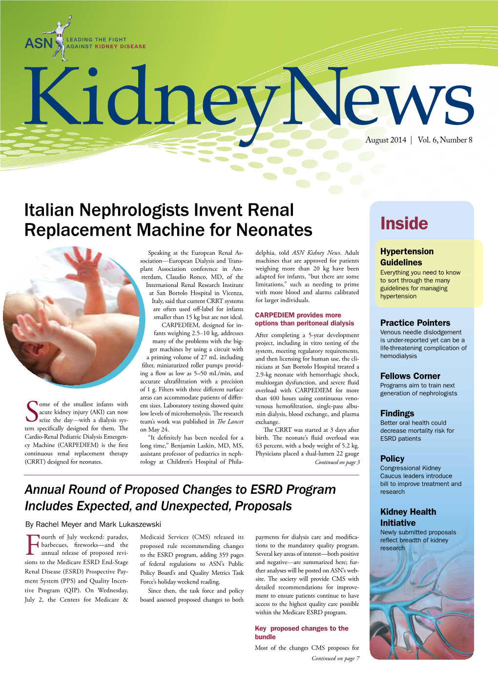 Italian Nephrologists Invent Renal Replacement Machine for Neonates Inside