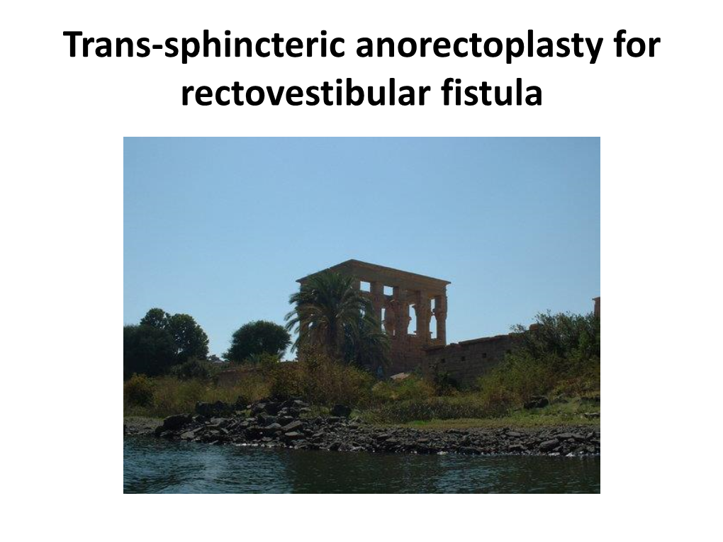 Trans-Sphincteric Anorectoplasty for Rectovestibular Fistula