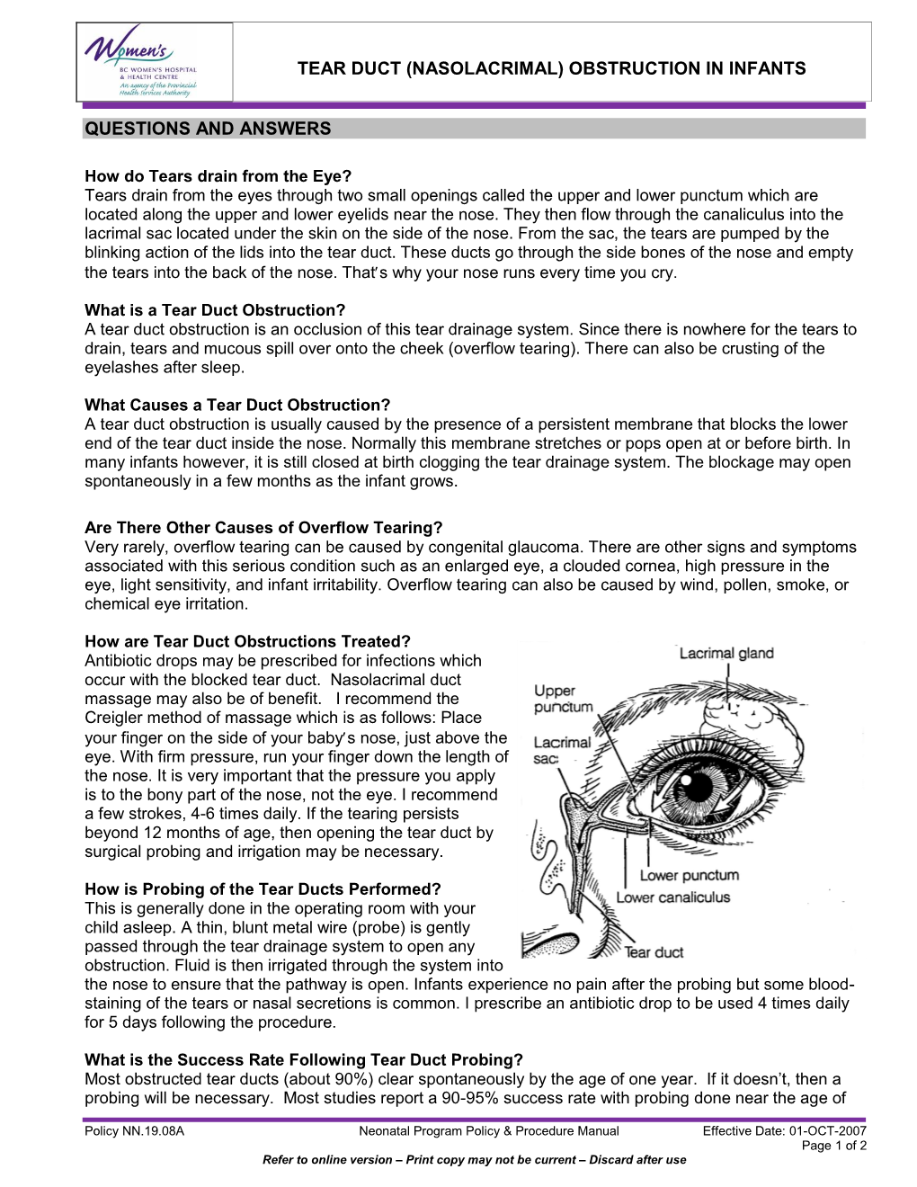 Tear Duct (Nasolacrimal) Obstruction in Infants