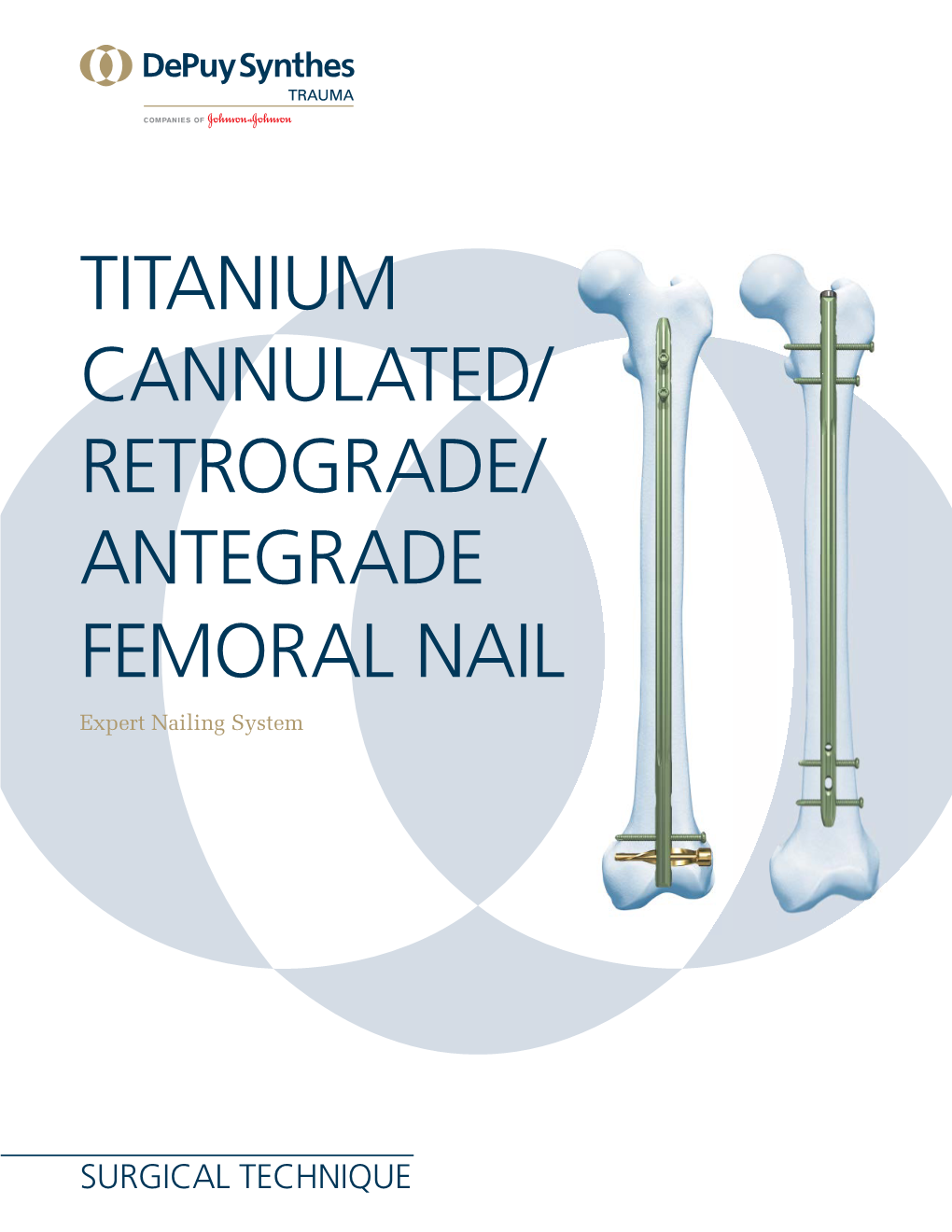 Titanium Cannulated/ Retrograde/ Antegrade Femoral NAIL Expert Nailing System
