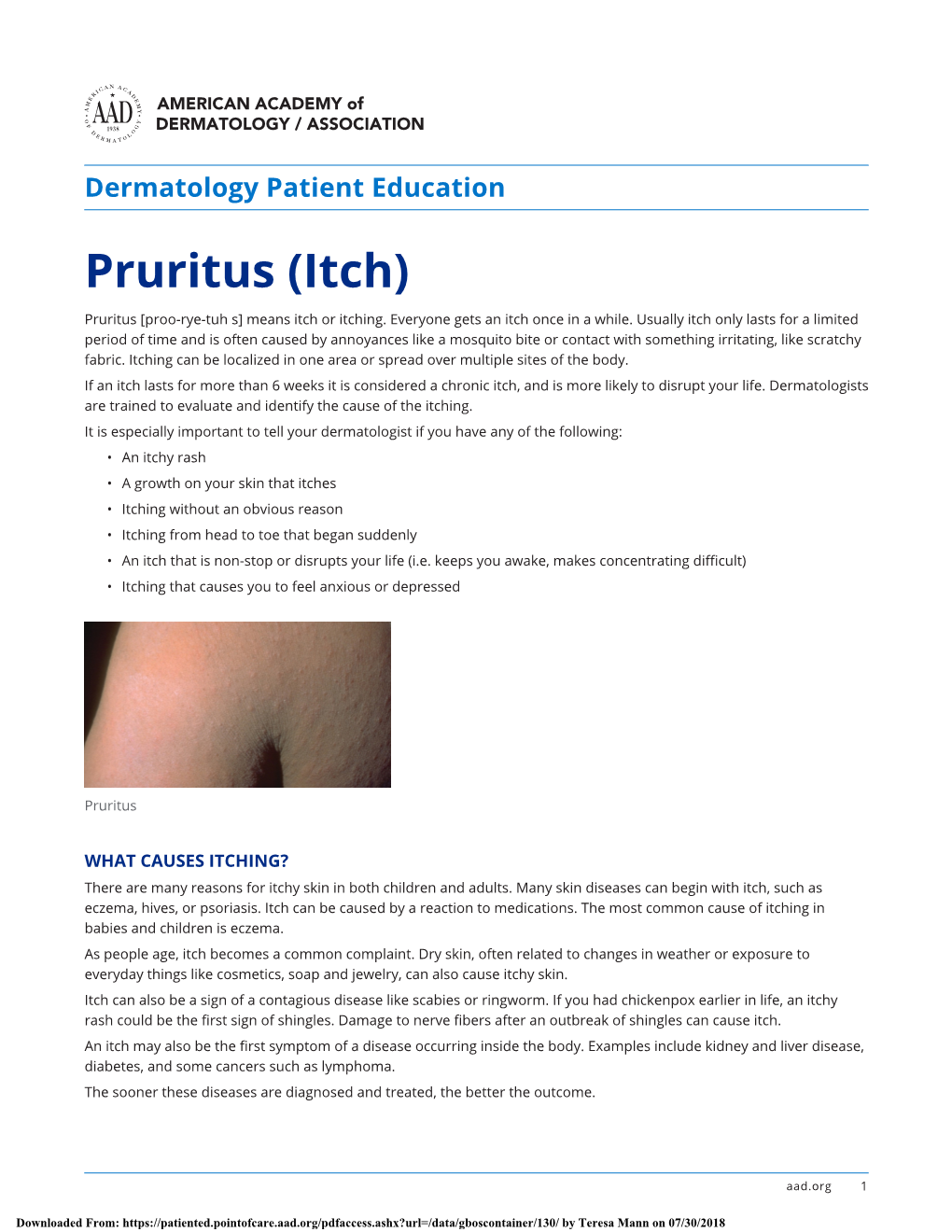 Pruritus (Itch) Pruritus [Proo-Rye-Tuh S] Means Itch Or Itching