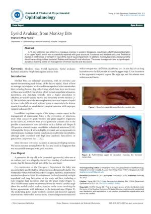 Eyelid Avulsion from Monkey Bite Stephanie Ming Young* Department of Ophthalmology, National University Hospital, Singapore