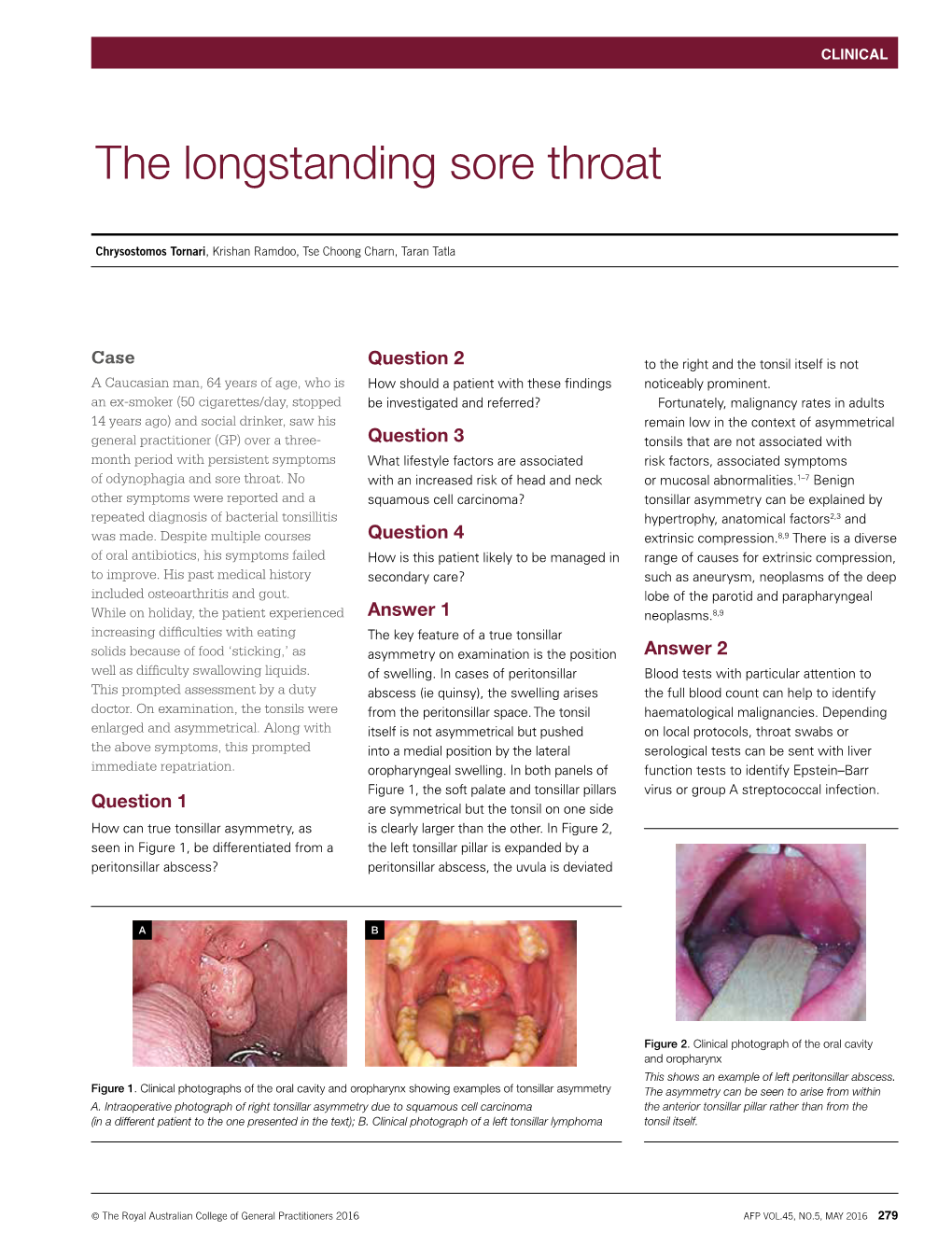 The Longstanding Sore Throat