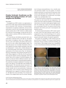 Ocular Ischemic Syndrome As the Initial Presenting Feature of Cyto