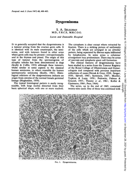 Dysgerminoma S