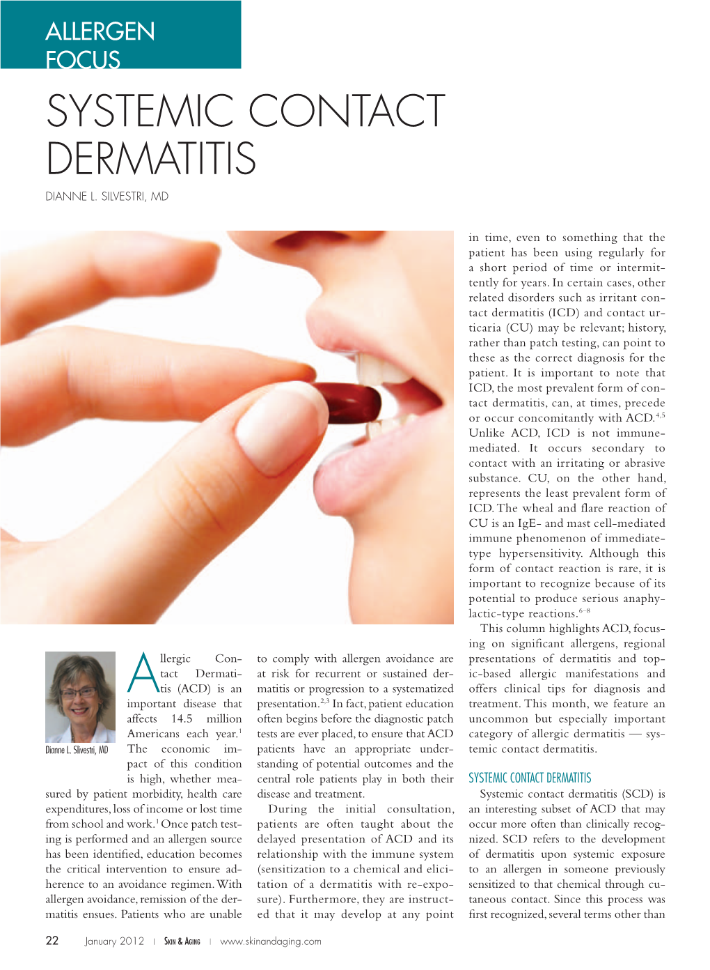 Systemic Contact Dermatitis Dianne L