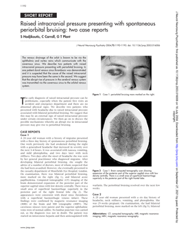 Raised Intracranial Pressure Presenting with Spontaneous Periorbital Bruising: Two Case Reports S Hadjikoutis, C Carroll, G T Plant