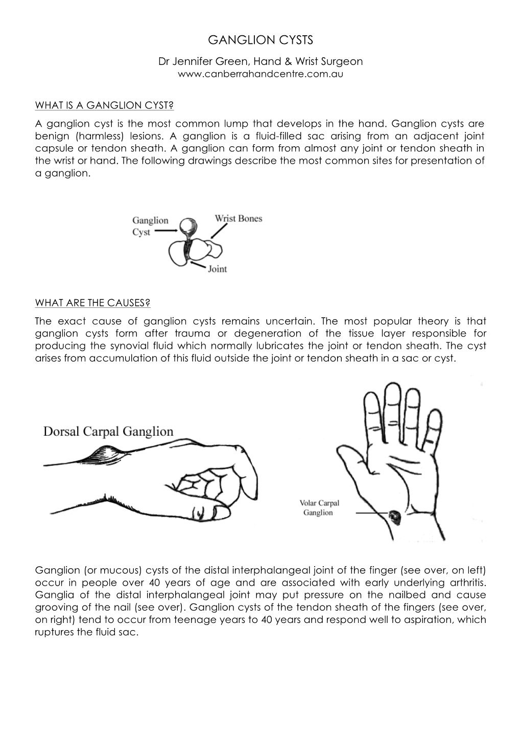 GANGLION CYSTS Dr Jennifer Green, Hand & Wrist Surgeon - DocsLib