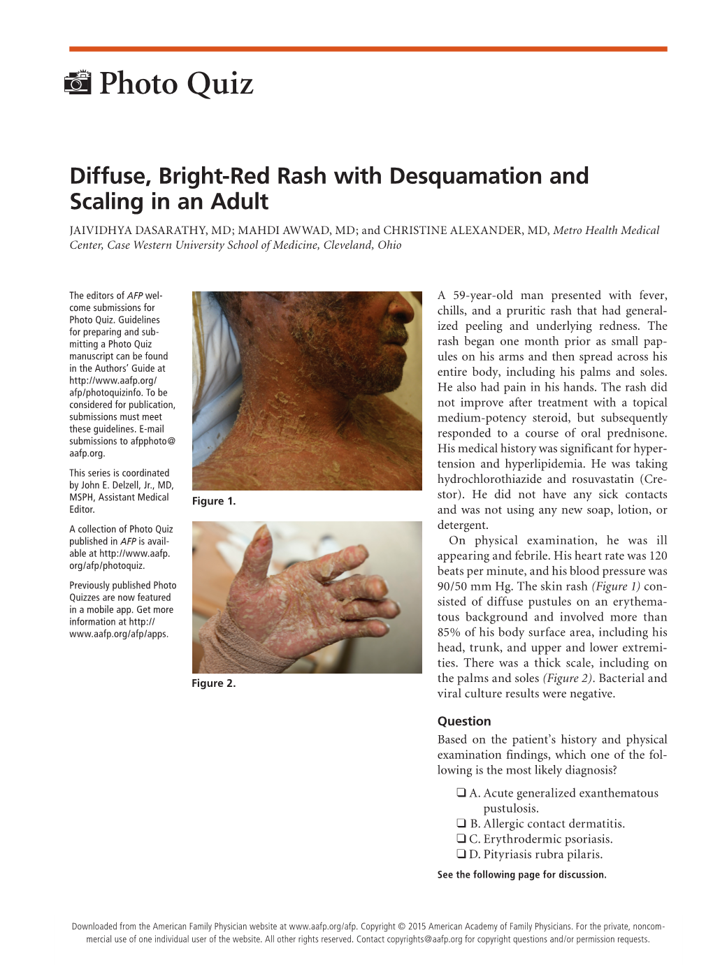 Diffuse, Bright-Red Rash with Desquamation and Scaling in An