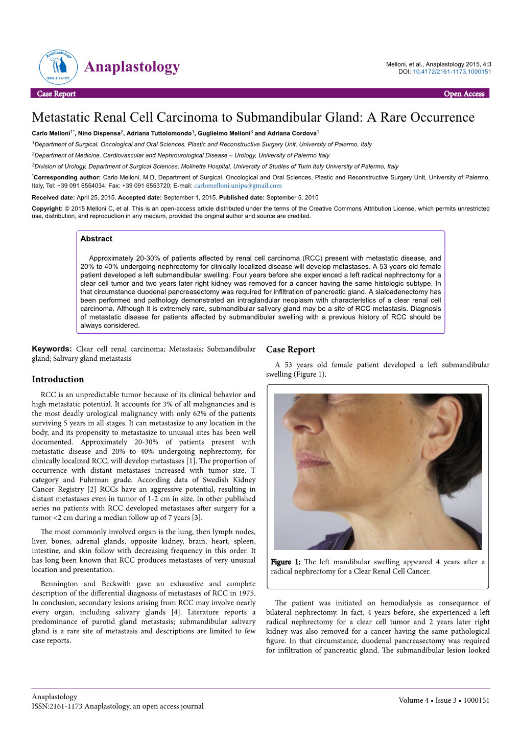 Metastatic Renal Cell Carcinoma to Submandibular Gland