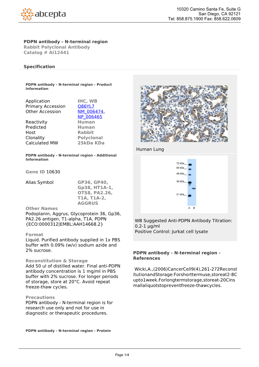 PDPN Antibody - N-Terminal Region Rabbit Polyclonal Antibody Catalog # AI12441