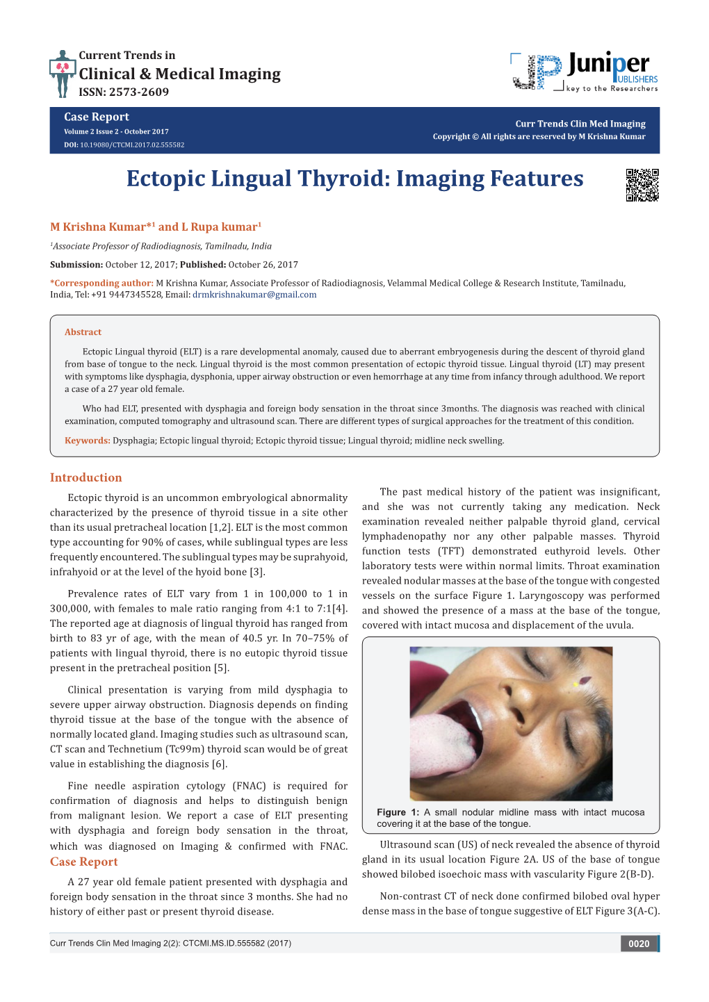 Ectopic Lingual Thyroid: Imaging Features