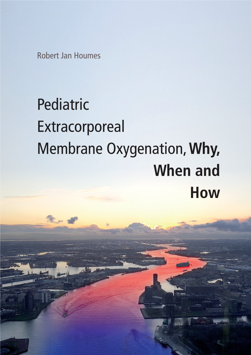 Robert Jan Houmes Jan Robert Pediatric Extracorporeal Membrane Oxygenation