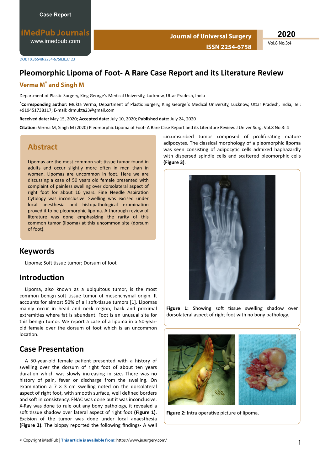 Pleomorphic Lipoma of Foot- a Rare Case Report and Its Literature Review Verma M* and Singh M