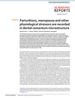 Parturitions, Menopause and Other Physiological Stressors Are Recorded in Dental Cementum Microstructure Paola Cerrito1,2,3*, Shara E