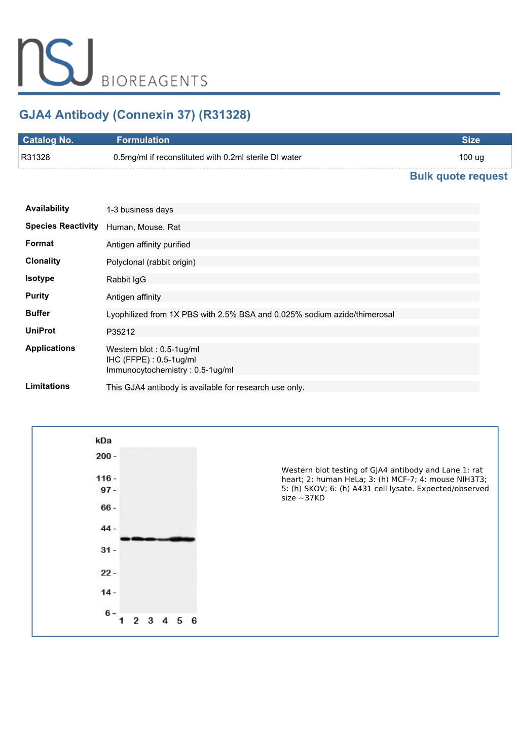 GJA4 Antibody (Connexin 37) (R31328)