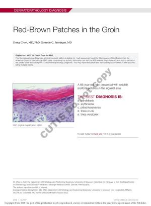 Red-Brown Patches in the Groin