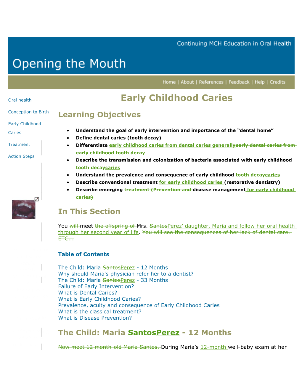 Early Childhood Caries