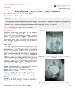 Large Primary Calculus in Female Urethral Diverticulum Abhay Dinkarrao Mahajan*, Sumeeta Abhay Mahajan Department of Urology, Sai Urology Hospital, India