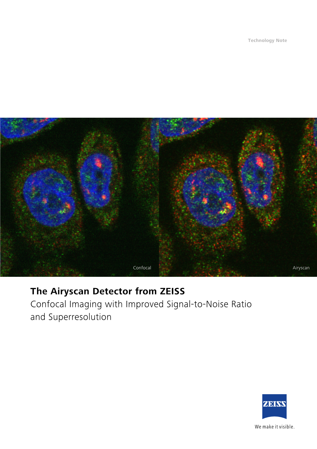 The Airyscan Detector From Zeiss Confocal Imaging With Improved Signal