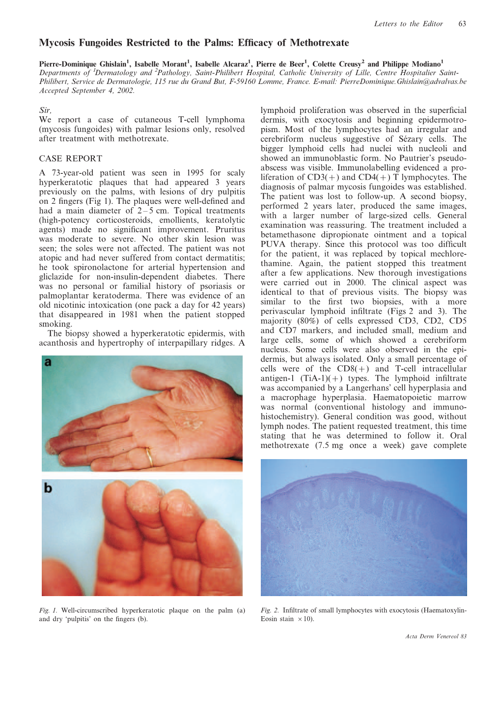 Mycosis Fungoides Restricted to the Palms: Efficacy of Methotrexate