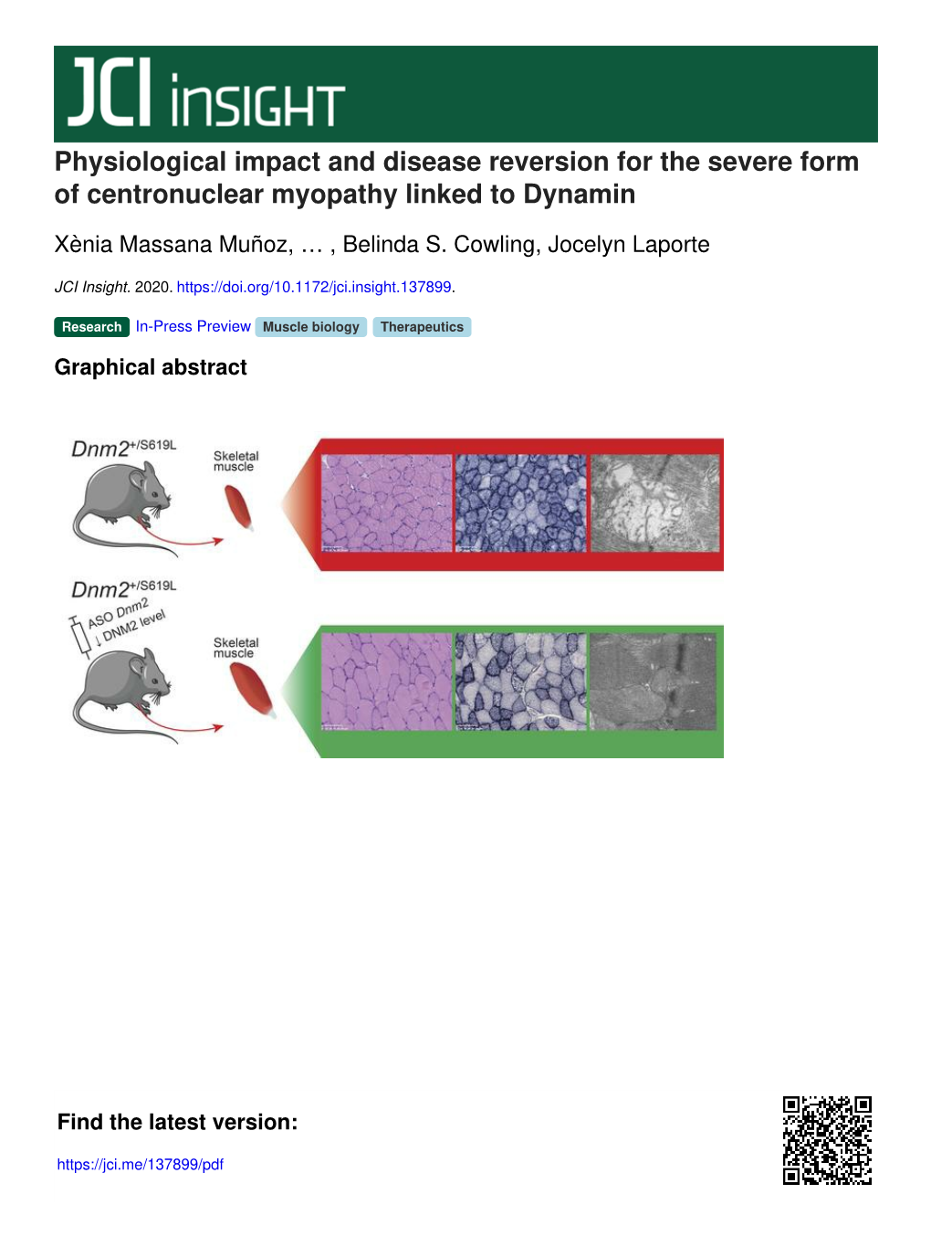 Physiological Impact and Disease Reversion for the Severe Form of Centronuclear Myopathy Linked to Dynamin