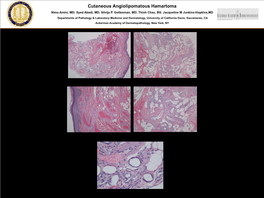 Cutaneous Angiolipomatous Hamartoma Nima Amini, MD; Syed Abedi, MD; Silvija P