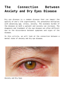 The Connection Between Anxiety and Dry Eyes Disease,Meibomian Gland Probing in the UK,Effects of Roaccutane on Eyes,Eye Drops Fo