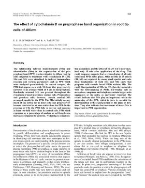 The Effect of Cytochalasin D on Preprophase Band Organization in Root Tip Cells of Allium