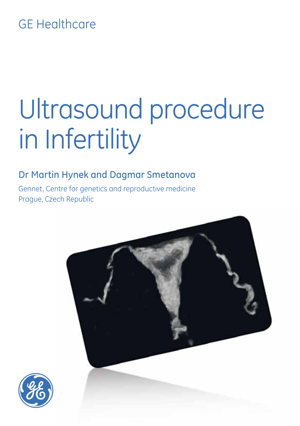 Ultrasound Procedure in Infertility