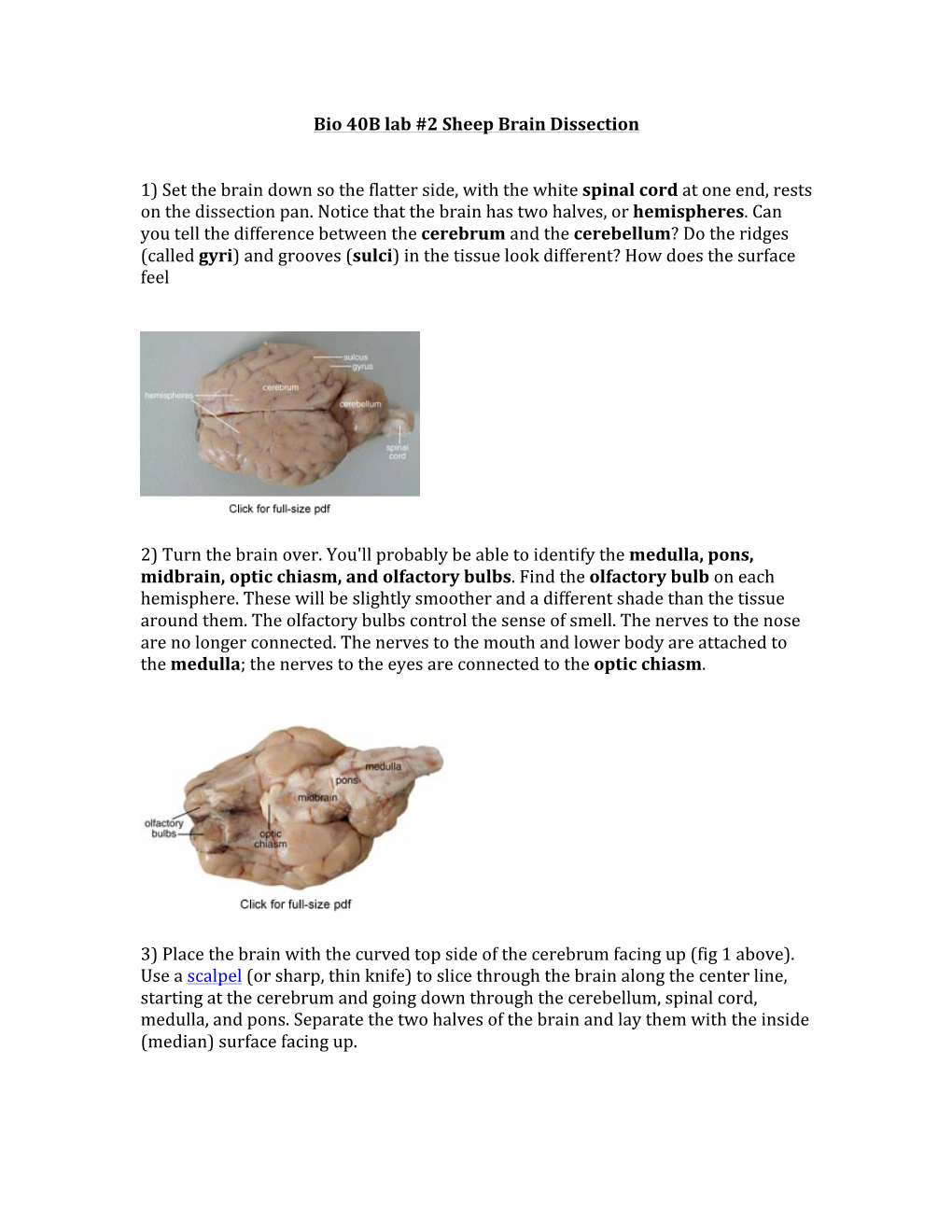 Bio 40B Lab #2 Sheep Brain Dissection 1) Set the Brain Down So